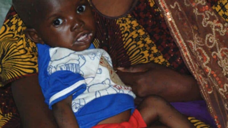 Malnutrition in Mali: causes, impact and solutions for children’s health