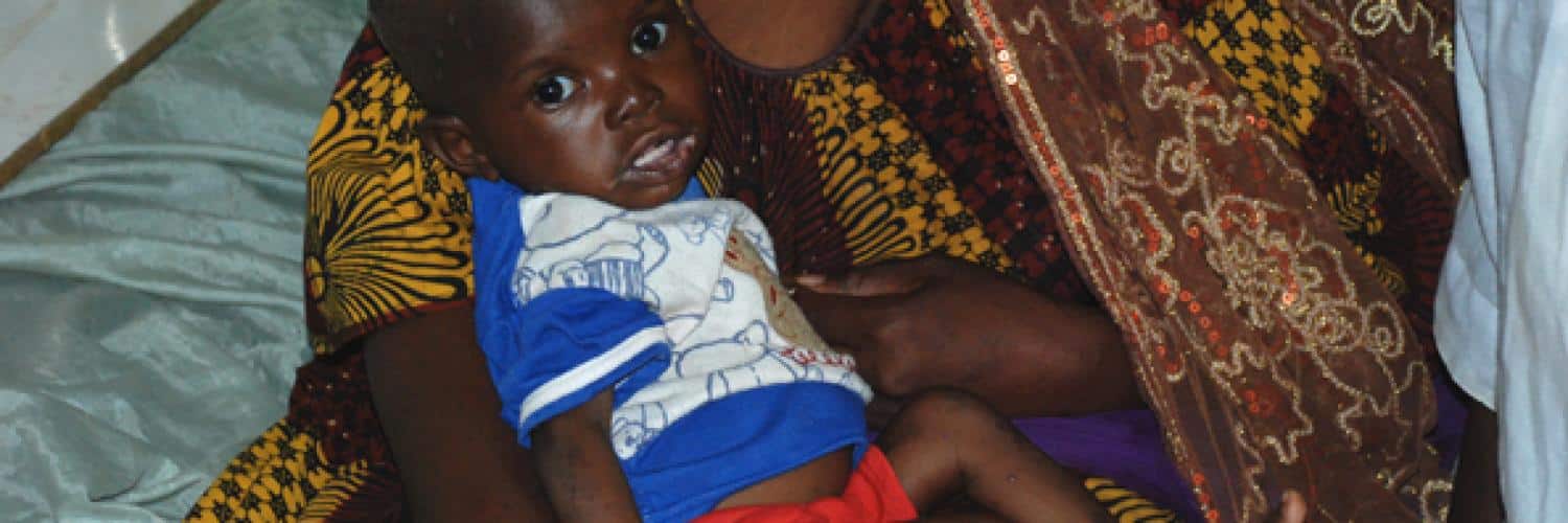 Malnutrition in Mali: causes, impact and solutions for children’s health