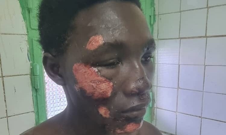 Chad: father demands action after son’s assault near military camp in n’djaména