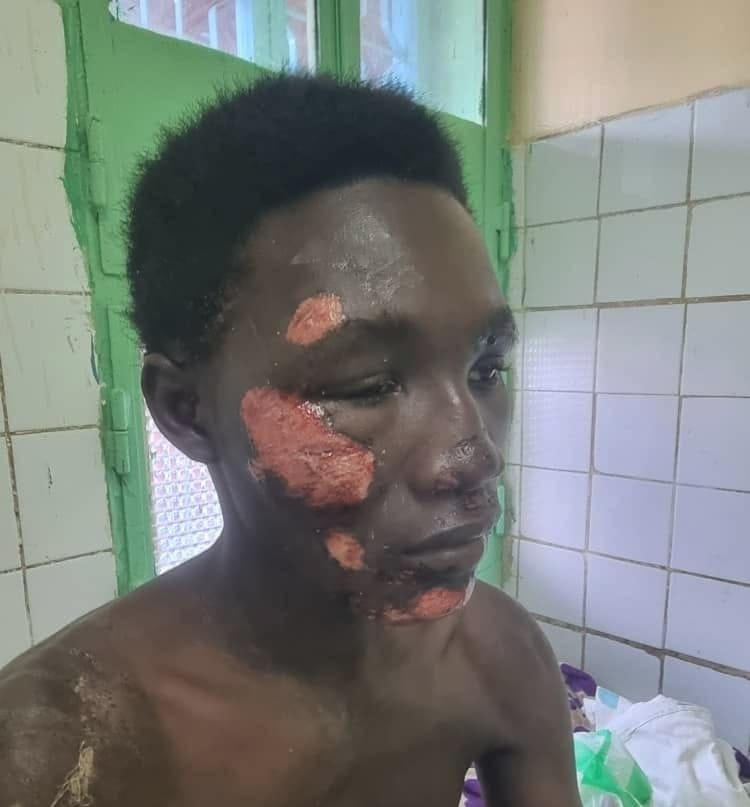 Chad: father demands action after son’s assault near military camp in n’djaména